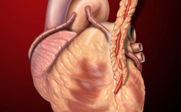 Что такое аортокоронарное шунтирование?